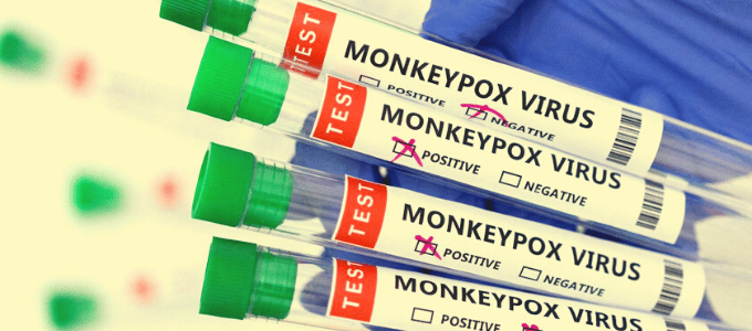 monkeypox test tube